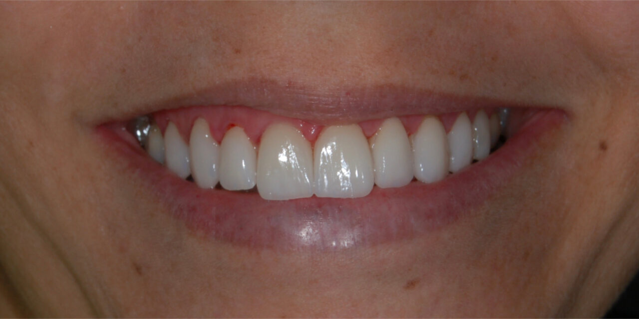 https://www.risoclin.com.br/wp-content/uploads/2021/05/02-1280x640.jpg