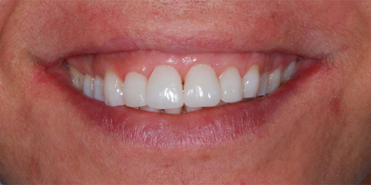 https://www.risoclin.com.br/wp-content/uploads/2021/05/10-1280x640.jpg
